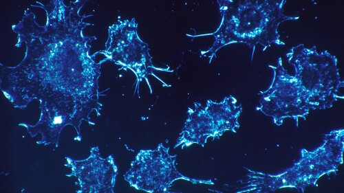 Blue cancer cells against a black background under a microscope.jpeg