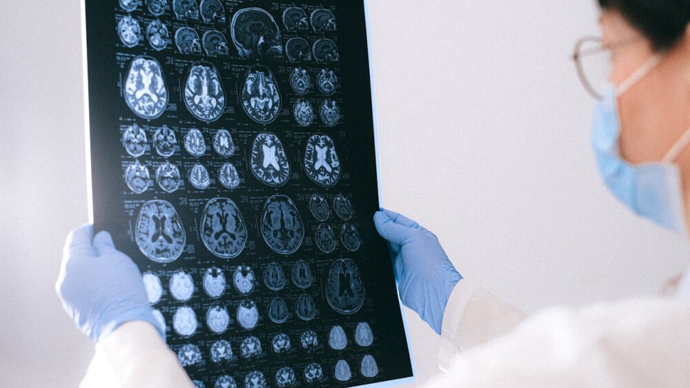 a doctor looking an xray results of a brain scan